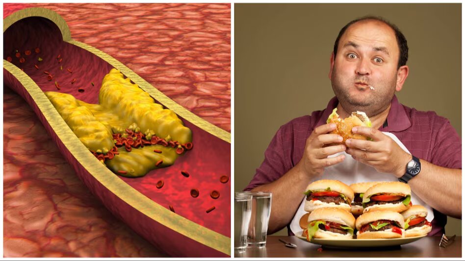 भारत के युवा क्यों हो रहे कोलेस्ट्रॉल बीमारी का शिकार, डरा देगी वजह